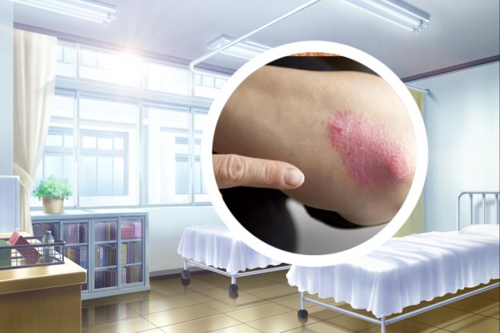金昌银屑病是一种常见的皮肤病吗